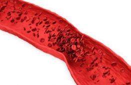 Разжижаем кровь: как спастись от инфаркта и инсульта Густая кровь что пить для разжижения крови